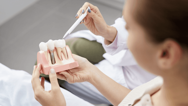 dentist looking at dental implant model | dental implant los gatos ca
