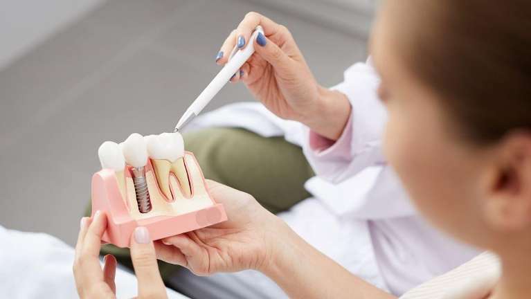 Dentist showing a patient a dental implant diagram in los gatos ca