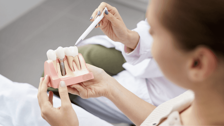 patient with dental implant model | dentist los gatos ca