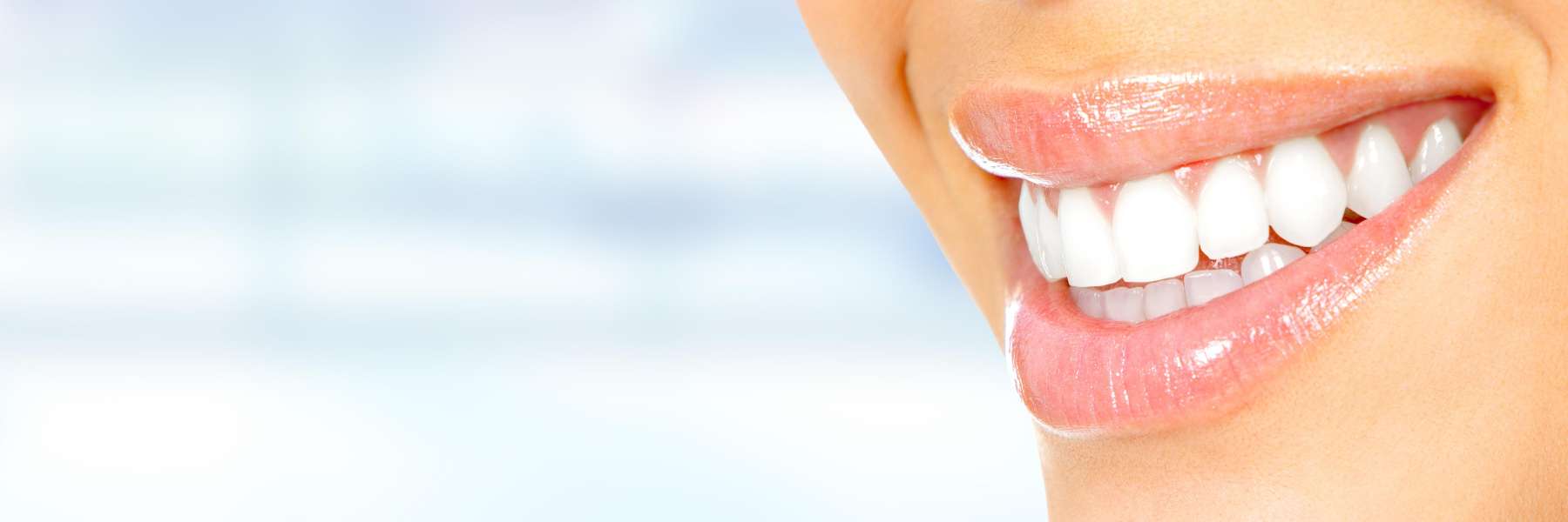 close up of bright smile | veneers los gatos ca