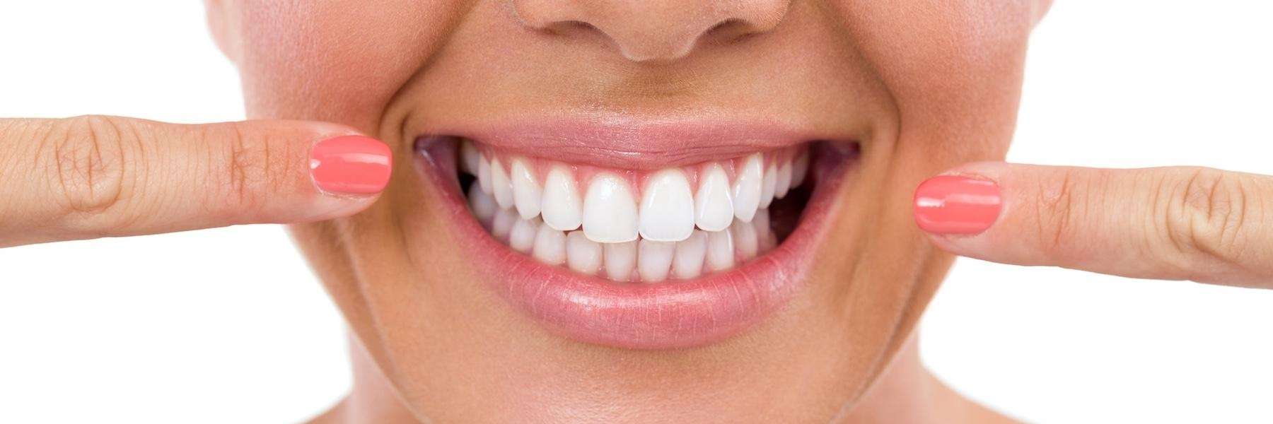close up of bright smile | dentist los gatos ca